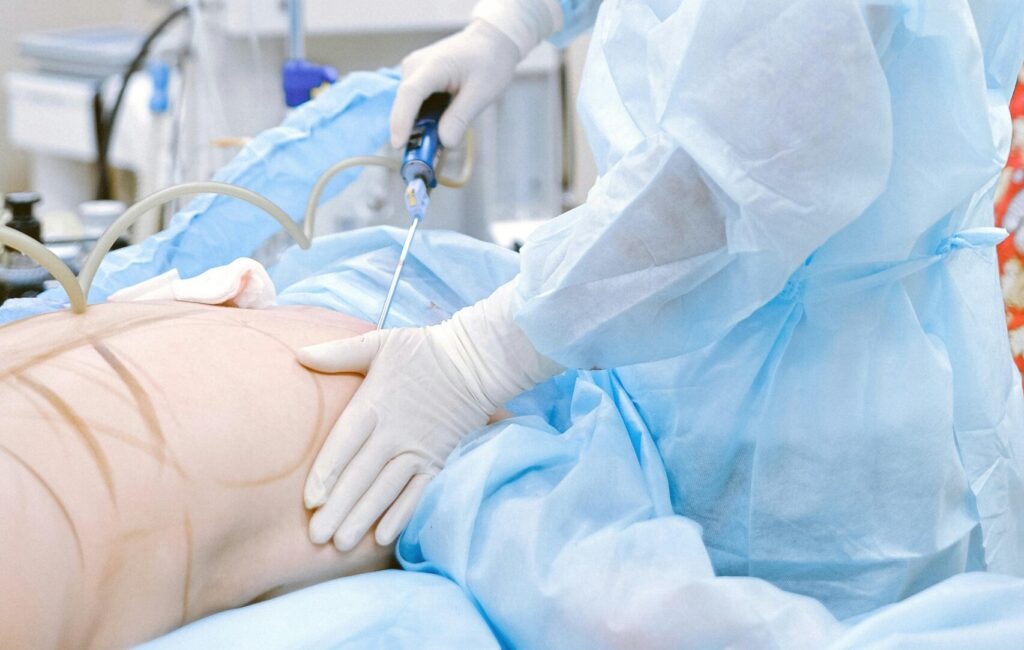Embalming process Representation